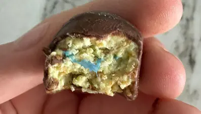 Dubai çikolatasının içinden çıktı: 6 yaşındaki çocuk ölümden döndü