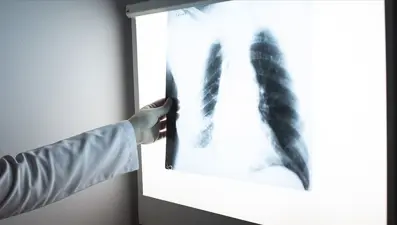 KOAH nedir, KOAH belirtileri nelerdir? KOAH tedavisi nasıl yapılır?