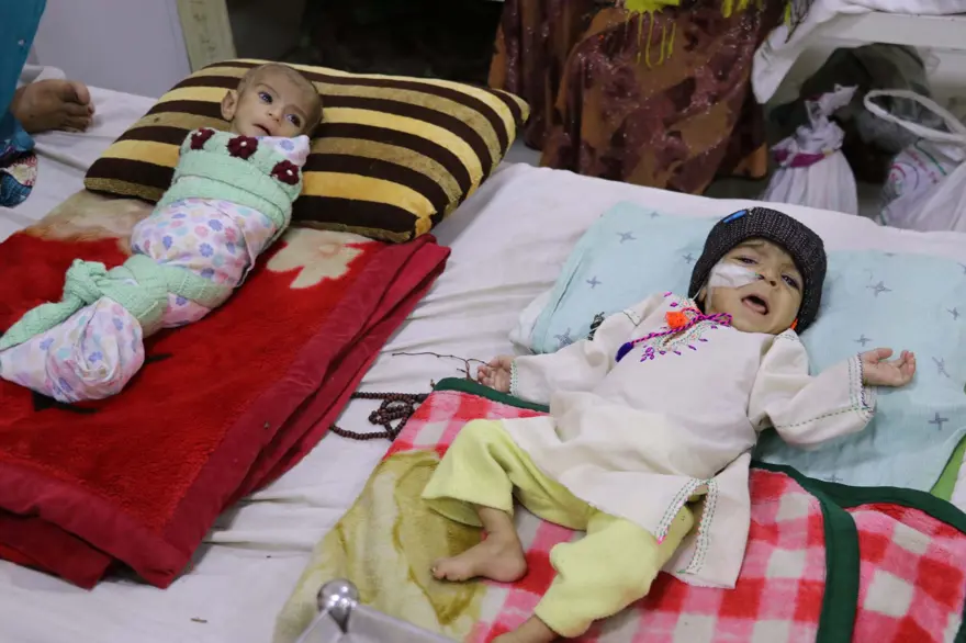 İnsanlık dramı: Sütten kesilen Afgan annelerin bebekleri büyüyemiyor 25 İnsanlık dramı: Sütten kesilen Afgan annelerin bebekleri büyüyemiyor 25