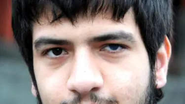 Arkadaşının attığı taş, göz rengini değiştirdi