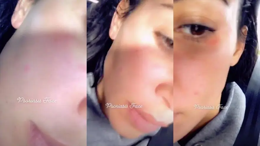 Kim Kardashian hastalığını anlattı: Acı verici ve korkutucu 4