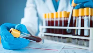 Kan grubu “0”olanlar corona virüse karşı daha avantajlı: İki yeni çalışma destekledi