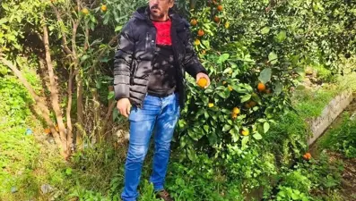 Kazada öldü sanıldı, kafatasında mermi çekirdeği bulundu