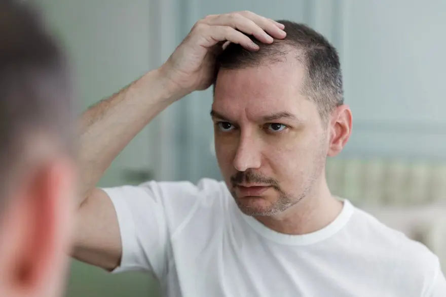 Dermatolog açıkladı: Mevsimsel saç dökülmesi neden oluyor? 1