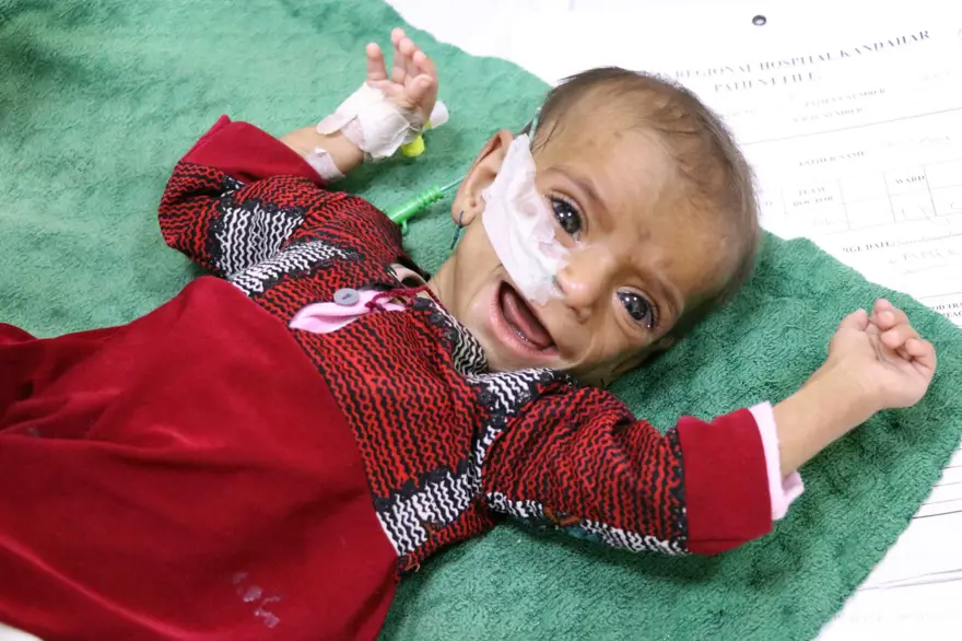 İnsanlık dramı: Sütten kesilen Afgan annelerin bebekleri büyüyemiyor 29 İnsanlık dramı: Sütten kesilen Afgan annelerin bebekleri büyüyemiyor 29