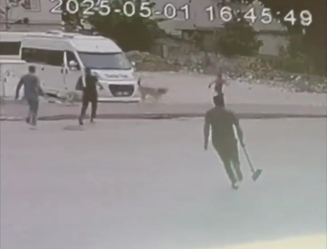 Sokak köpekleri çocuğa saldırdı