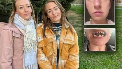 Danimarkalı ikizlerin Türkiye'de diş tedavisi kabusu