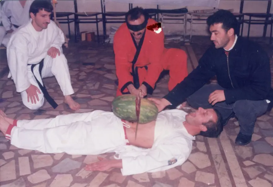 Güç gösterileri ustası karateci, kanserden kolunu kaybetti 10 Güç gösterileri ustası karateci, kanserden kolunu kaybetti 10