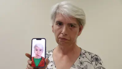 Gözüne takılan altın implantla hayatı değişti: 41 yıl sonra rüya görmeye başladım