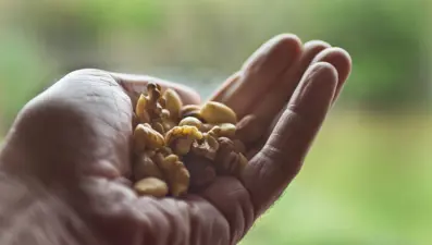 Genel cerrah ''Kolon kanserini önlüyor'' diyerek ısrarla tavsiye etti: Günde bir avuç tüketmek bile yetiyor