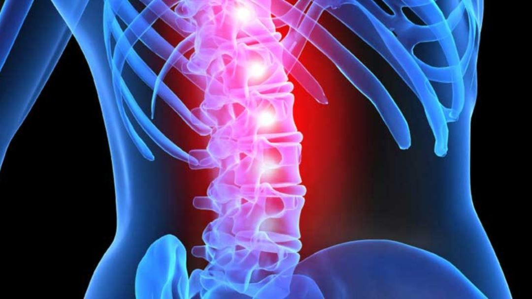 Her bin çocuktan biri bu hastalıkla doğuyor: Ayrık omurga (Spina-Bifida)