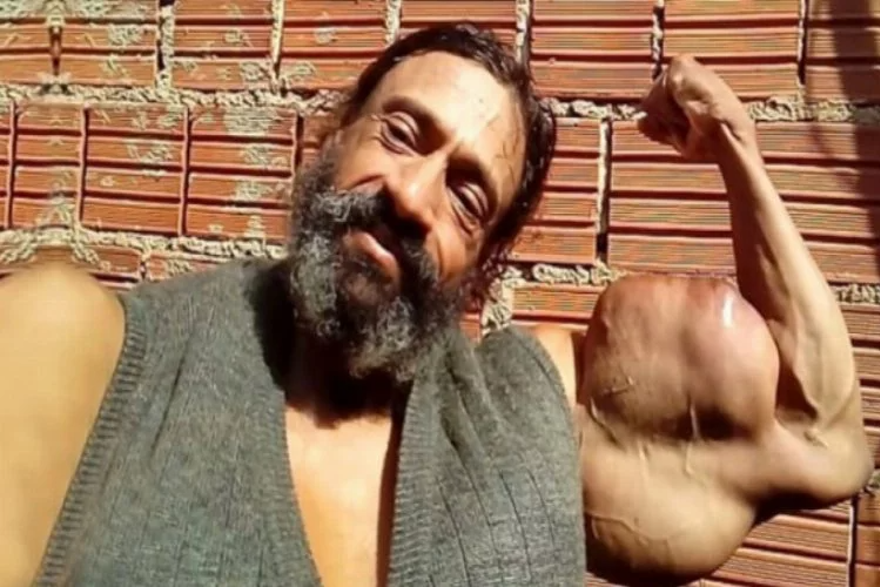 "Brezilyalı Hulk" 55. doğum gününde hayatını kaybetti 6