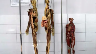 Tıp fakültesinde kadavra krizi: Türkiye’de bulunamıyor,ithal edecekler