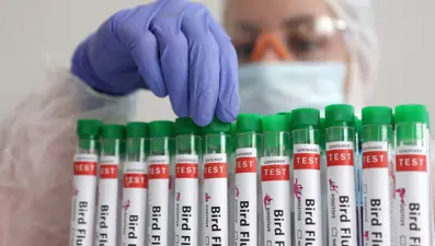 Kuş gribinde korkutan vaka: İlk kez hayvanla teması olmayan bir insanda görüldü