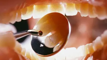 Kalp krizi sinyali ağızda başlıyor