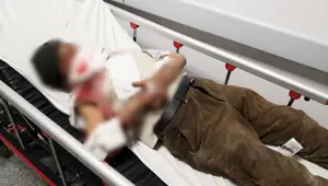 Misafirliğe giden yaşlı adama köpek saldırısı