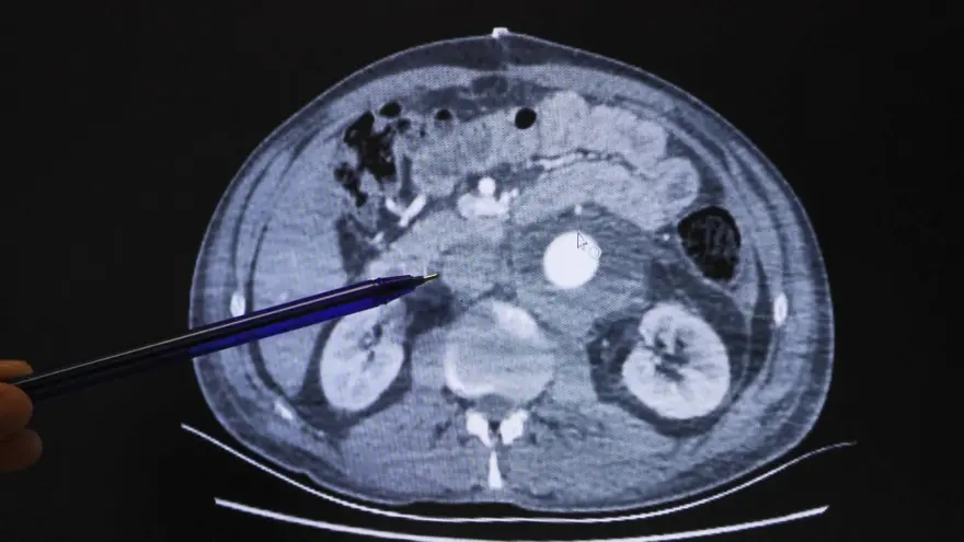 "HAYATTA KALMAM MUCİZE GİBİ" 4