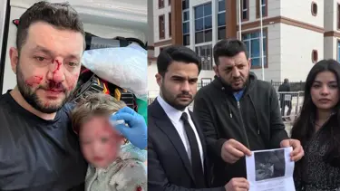 Yalova'da babacık ile 14 aylık kızının darbedilmesi. Bebeğe vurduğunu giriş etti!  