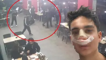 Antalya'da akran dehşeti! "Neden bakıyorsun" deyip burnunu kırdılar