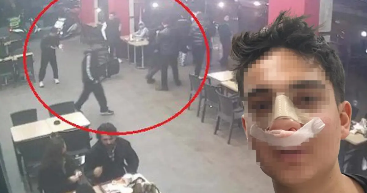 Antalya'da akran dehşeti! "Neden bakıyorsun" deyip burnunu kırdılar