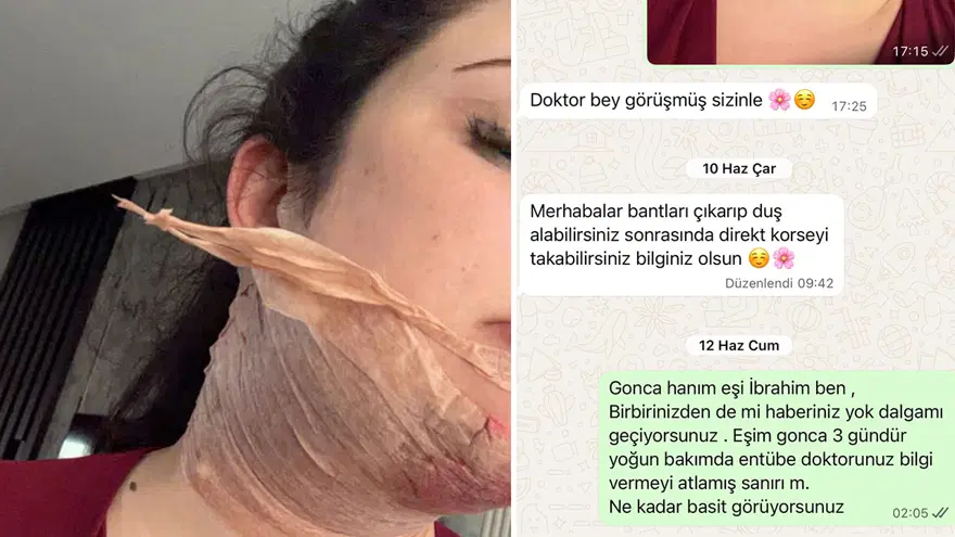 ACİL SERVİSE BAŞVURDU 2