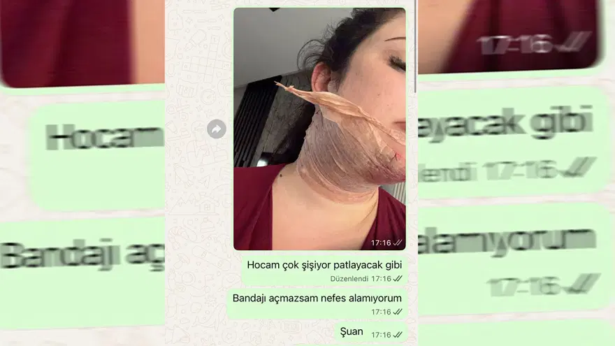 “NEFES ALAMIYORUM” 1