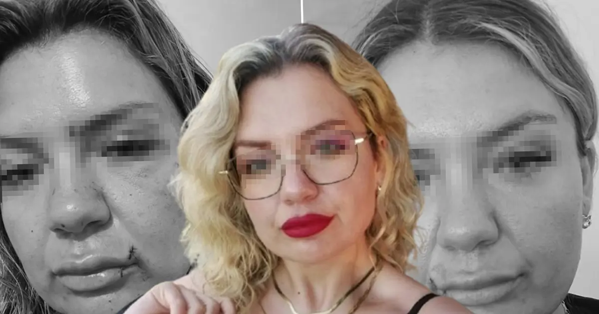 "Bugün büyük gün" diyerek aradı dehşeti yaşattı: Bıçak sırtında kırıldı