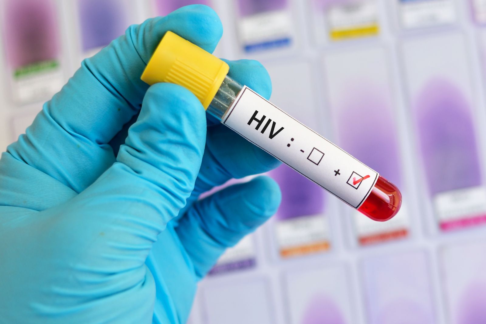 Gana'da AIDS kabusu: Bir yılda 9 bin 354 can kaybı