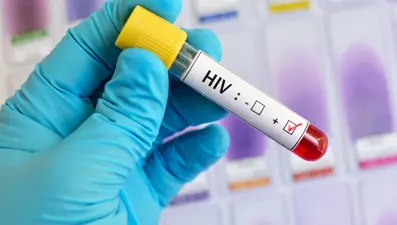 Gana'da AIDS kabusu: Bir yılda 9 bin 354 can kaybı