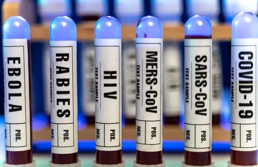 DSÖ uyardı: 2022 FIFA Dünya Kupası Covid-19'dan daha ölümcül bir pandeminin kaynağı olabilir (Deve gribi nedir?) 1