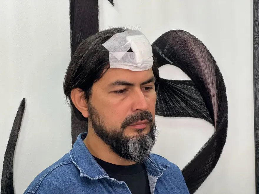 Kastamonu’da öğretmene delgeçli saldırı: Başına 5 dikişatıldı 2