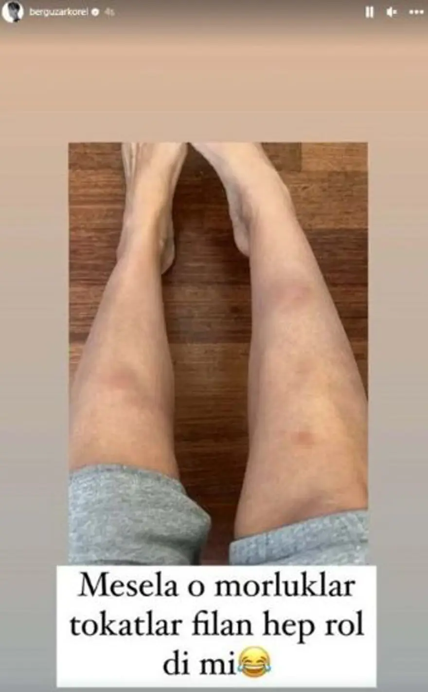 "O MORLUKLAR HEP ROL DEĞİL Mİ?" 4