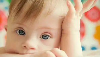 Dünya Down Sendromu Farkındalık Günü nedir, ne zaman kutlanır?