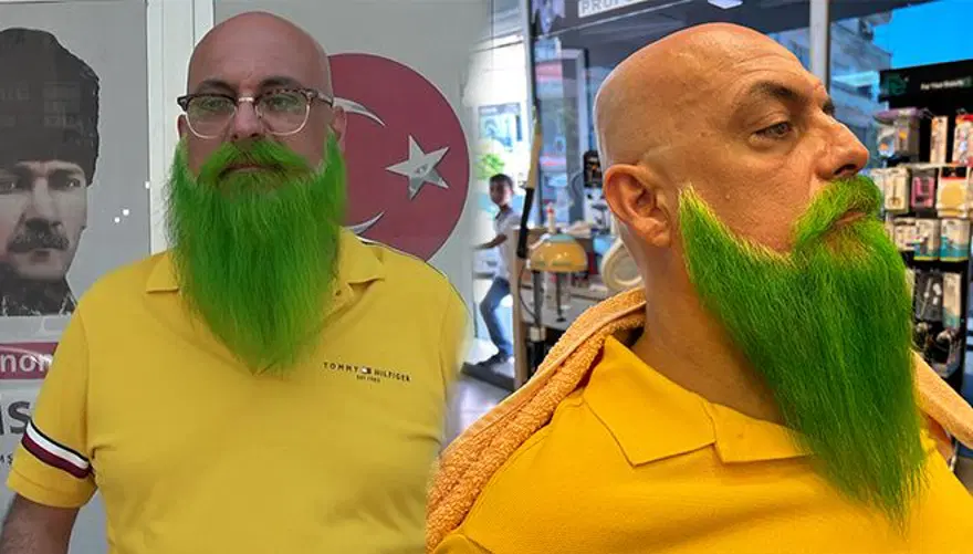 Sakalları gören herkesin dikkatini çekiyor! Rengi ruh haline göre değişiyor 