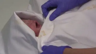 Mucize bebek: Annesinin beyin ölümünden sonra doğdu