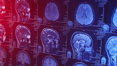 Sosyoekonomik eşitsizlik beyninizi yaşlandırıyor!