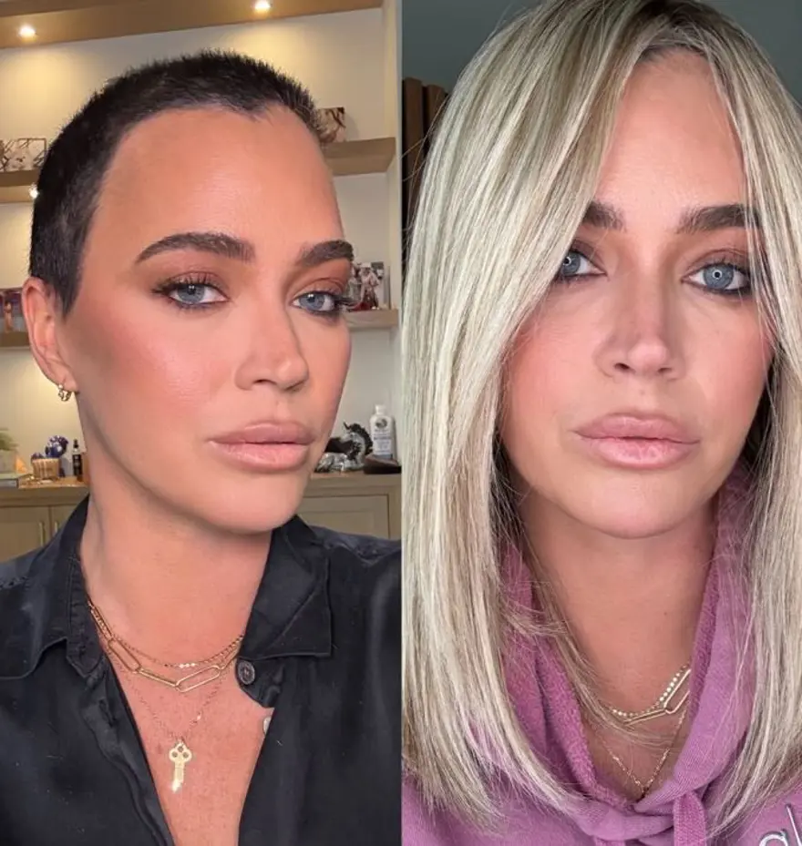 4. evre kanser teşhisi konulan Teddi Mellencamp galada: Hastalık akciğerlerine ve beynine yayılmış 4 4. evre kanser teşhisi konulan Teddi Mellencamp galada: Hastalık akciğerlerine ve beynine yayılmış 4