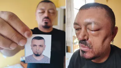 Berberi önerdi: Siyah saç şampuanı kör ediyordu