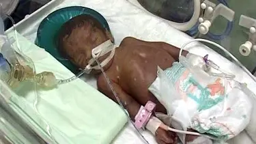 Mucize bebek kurtarılamadı