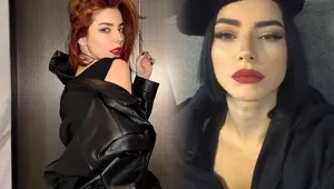 Merve Boluğur takipçisine verdiği yara bandı örneğiyle çok konuşuldu