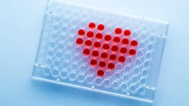 İskemi nedir? İskemik kalp hastalığı neden olur, tedavisi nasıl yapılır?