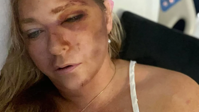 Pedofili milyarder Epstein kurbanı kadın kaza geçirdi!  "Sayılı günüm kaldı"