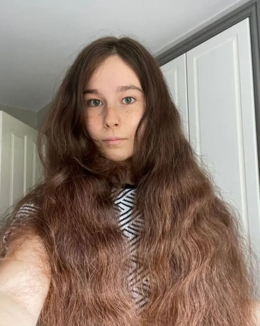 Saçlarını 1 yıldır yıkamıyor: Ailem ve arkadaşlarım deli olduğumu düşünüyor 