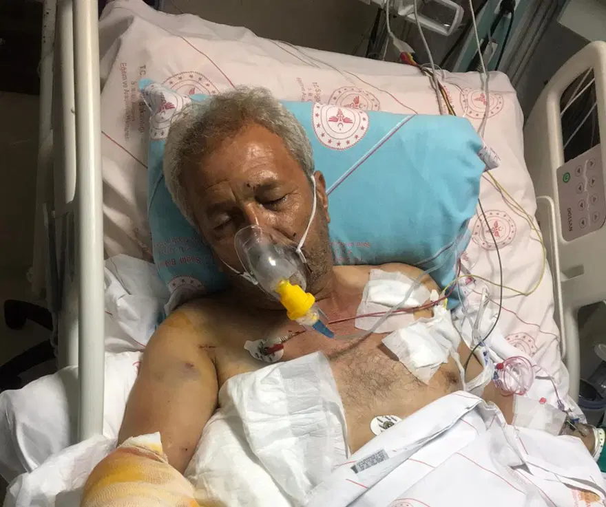 Eski muhtarın vurduğu ağabeyine 300’e yakın saçma isabetetti 2 Eski muhtarın vurduğu ağabeyine 300’e yakın saçma isabetetti 2