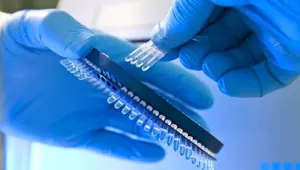 Corona virüsü 1 saatte test eden Qiagen 11.5 milyar dolara satılıyor Corona virüsü 1 saatte test eden Qiagen 11.5 milyar dolara satılıyor