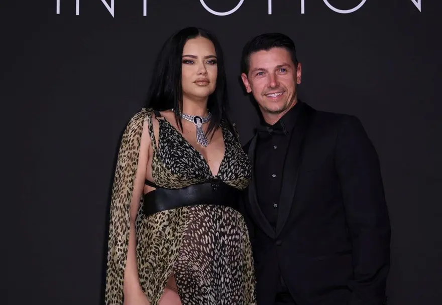 Yüzündeki değişimle şaşırtan Adriana Lima sessizliğini bozdu 9 Yüzündeki değişimle şaşırtan Adriana Lima sessizliğini bozdu 9