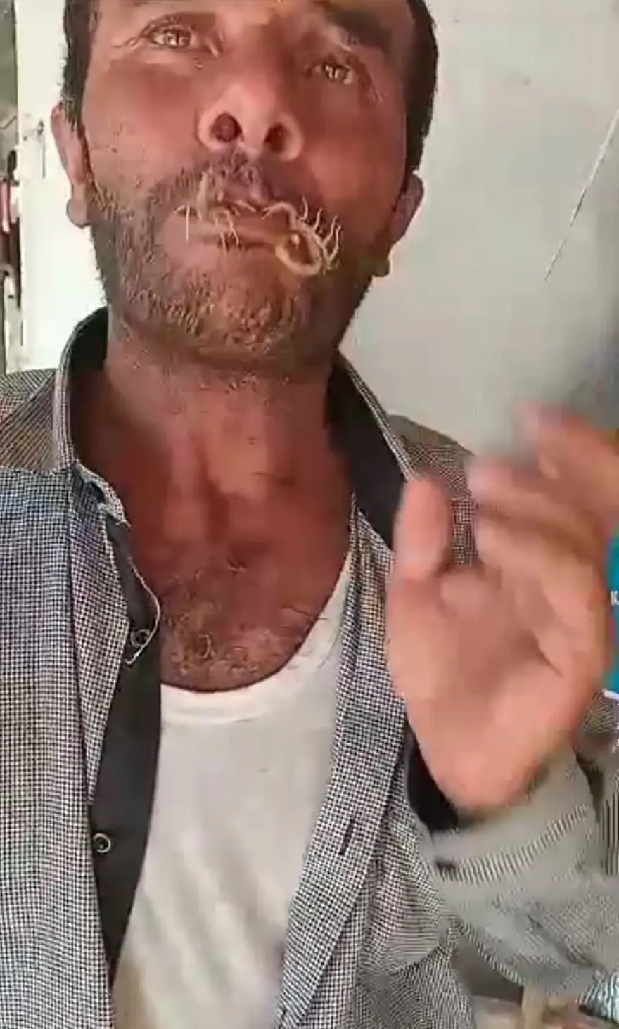 İki akrebi ağzına alıp kendini sokturdu 4