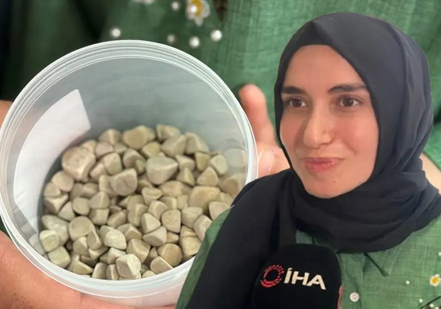 Doktorlar bile şaşırdı: Genç kızın vücudundan 287 adet taş çıkarıldı 