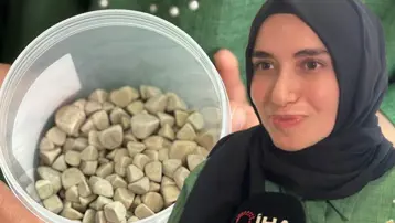 Doktorlar bile şaşırdı: Genç kızın vücudundan 287 adet taş çıkarıldı