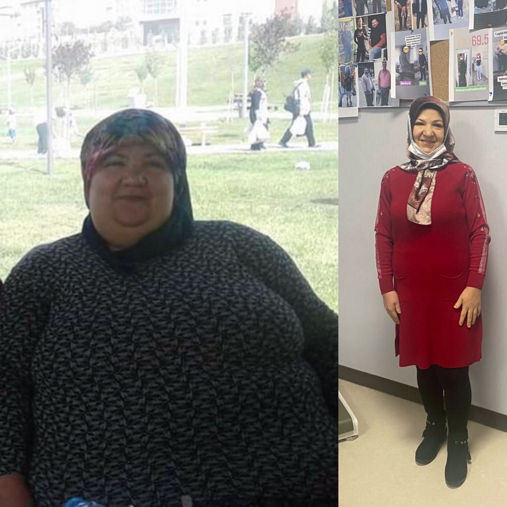 2 yılda 95 kilo verdi: Çorabımı bile giyemiyordum